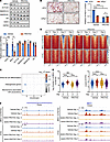Deficiency of SGK3 impairs chromatin remodeling during preadipocyte differe