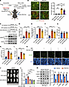 Pharmaceutical targeting of SGK3 attenuates HFD-induced obesity in mice and