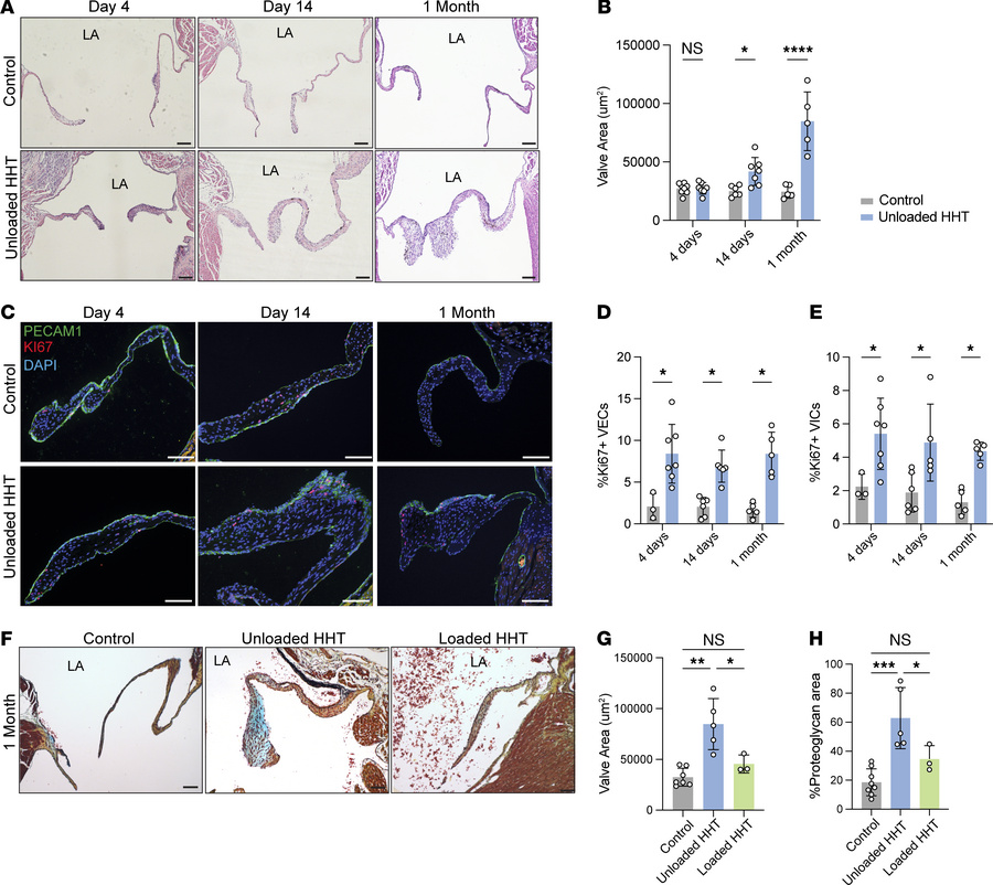 Hemodynamic unloading leads to formation of myxomatous valves.
(A) H&amp...