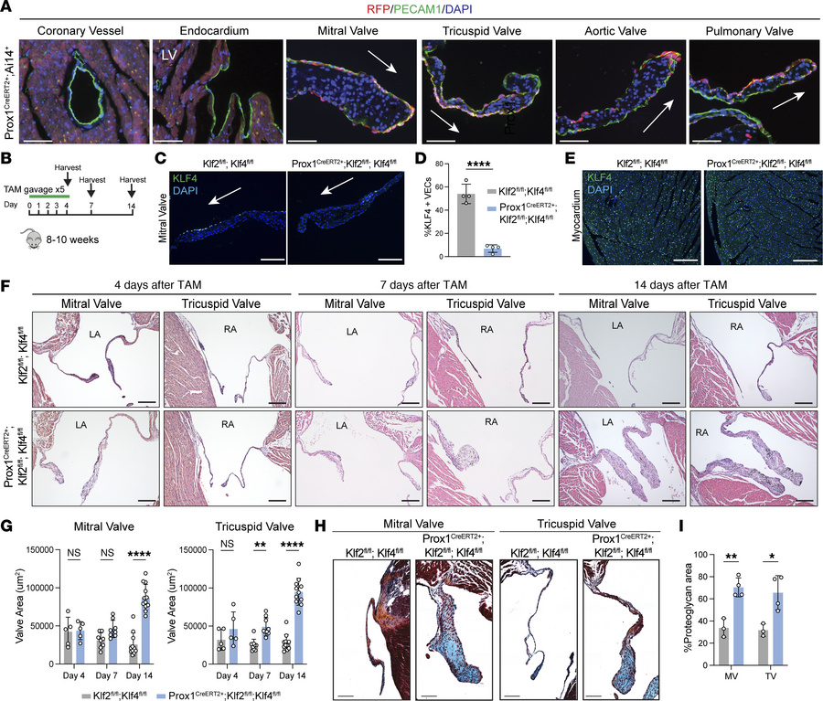 Genetic loss of endothelial KLF2/4 in the mature heart valve results in ...