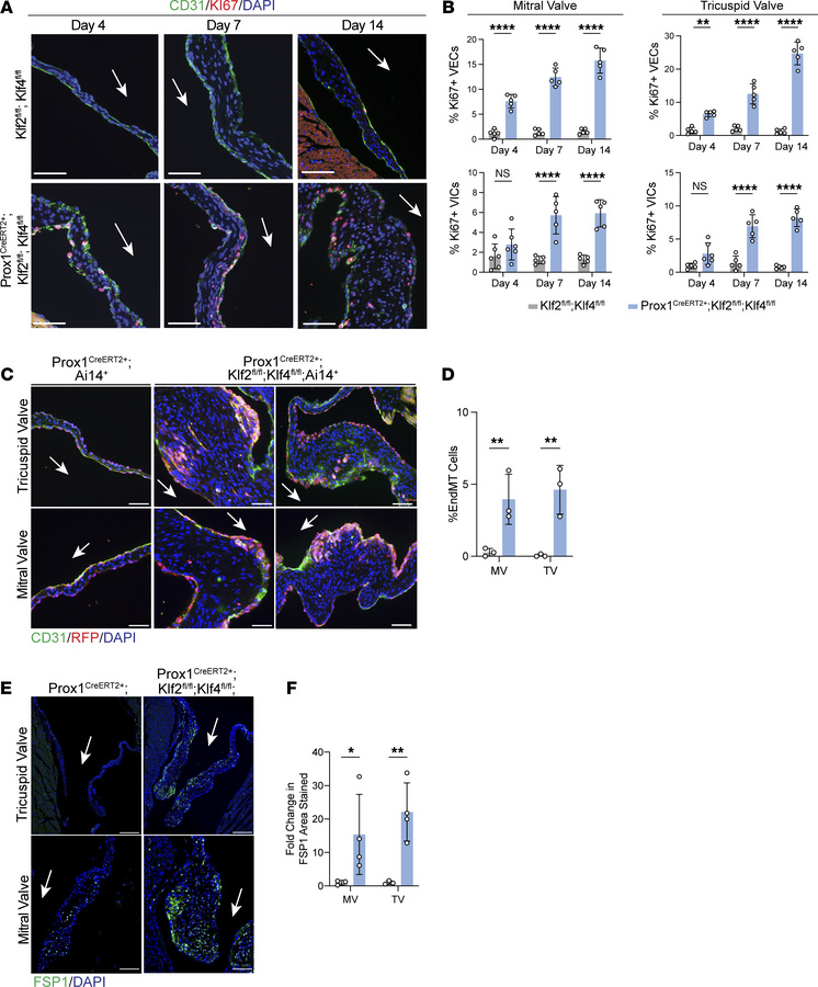Loss of endothelial KLF2/4 in the mature heart valve leads to proliferat...