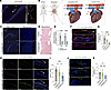 Hemodynamic forces control KLF2/4 expression in adult valve endothelial cel