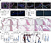 Genetic loss of endothelial KLF2/4 in the mature heart valve results in myx