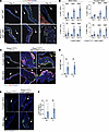 Loss of endothelial KLF2/4 in the mature heart valve leads to proliferation