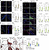 Increased p-SMAD2 in myxomatous valves from Prox1CreERT2+ Klf2fl/fl Klf4fl/