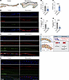 KLF2/4 and p-SMAD2 are altered in human myxomatous mitral valves.