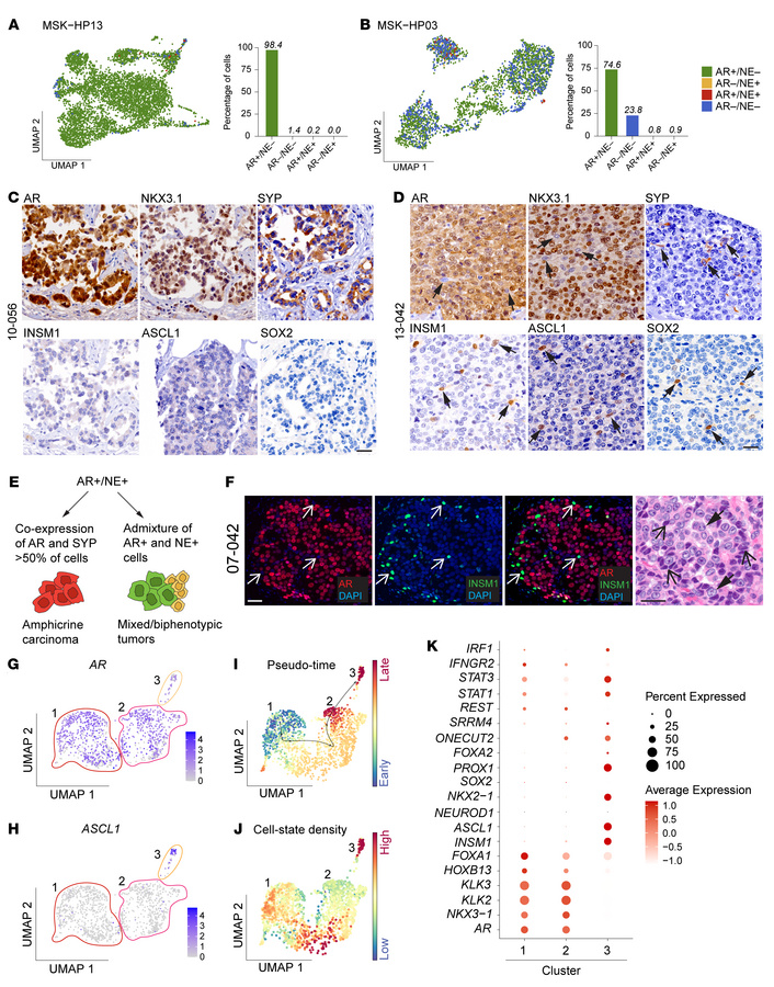 Dissecting molecular subtype pattern at the single-cell level.
UMAP and ...