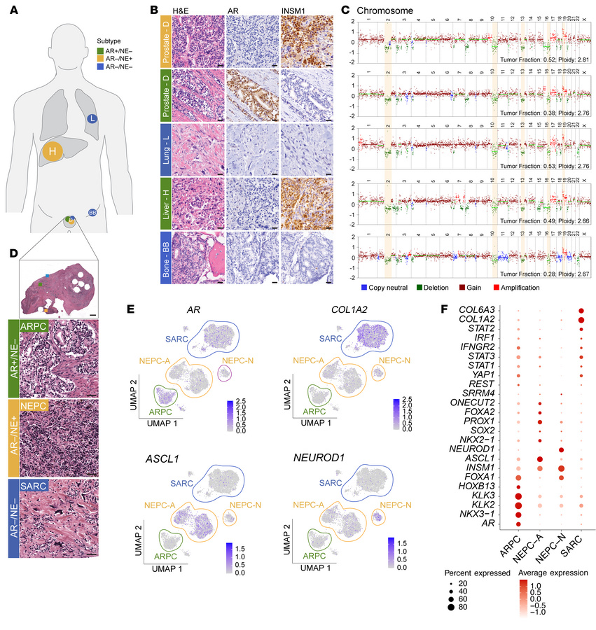 Inter- and intratumoral heterogeneity at the single-patient level.
(A) S...