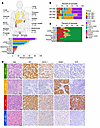 Study cohort and associations between molecular subtype and organ sites.