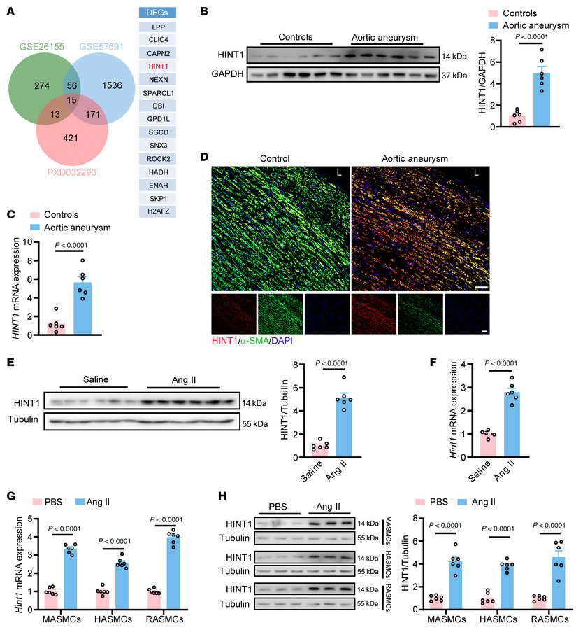 Upregulation of HINT1 correlates with aortic aneurysm.
(A) Differentiall...