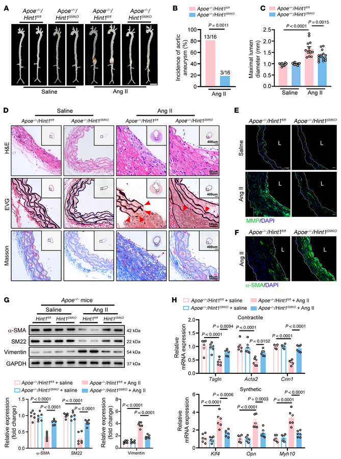 
Hint1 deficiency in VSMCs mitigates aortic aneurysm.
Saline (n = 12 per...