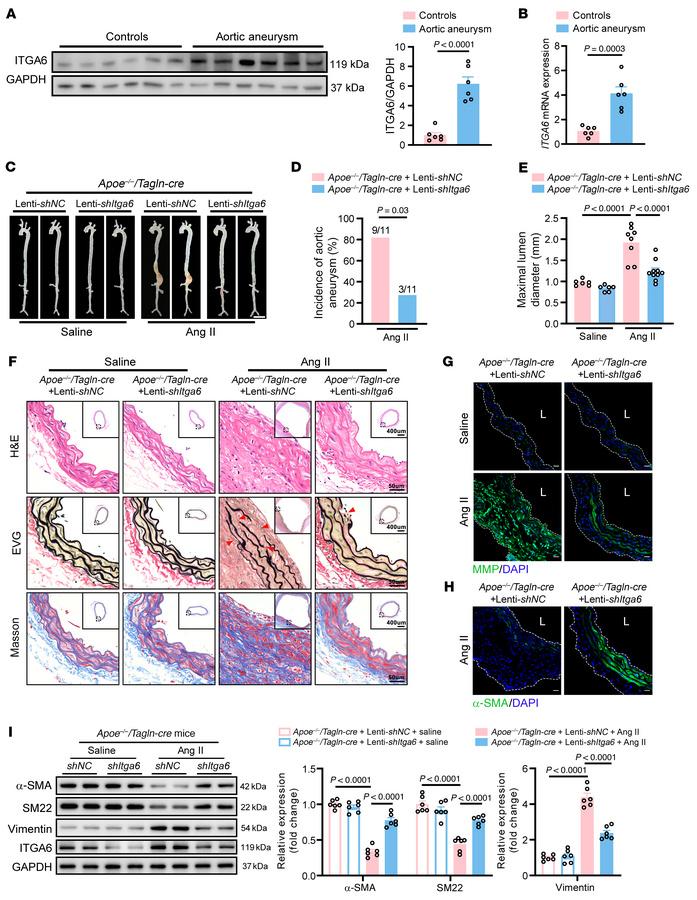 Knockdown of Itga6 in VSMCs mitigates aortic aneurysm.
(A and B) Western...