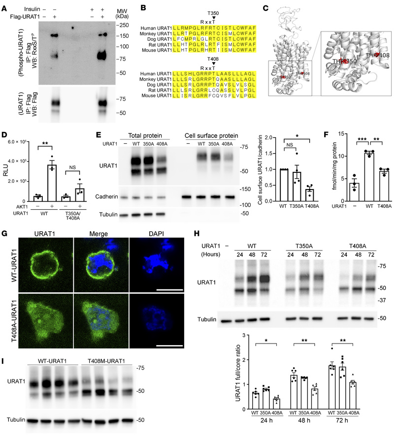 T408 phosphorylation regulates URAT1 trafficking and urate transport act...