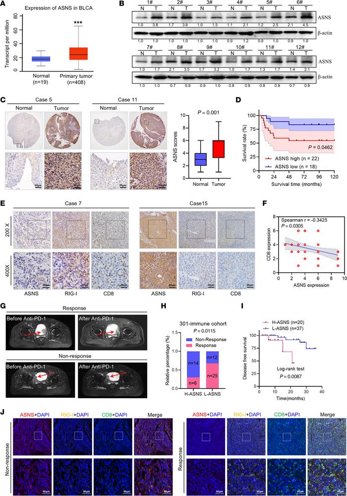 Upregulated S leads bladder cancer resistance to ICIs.
(A) mRNA levels o...