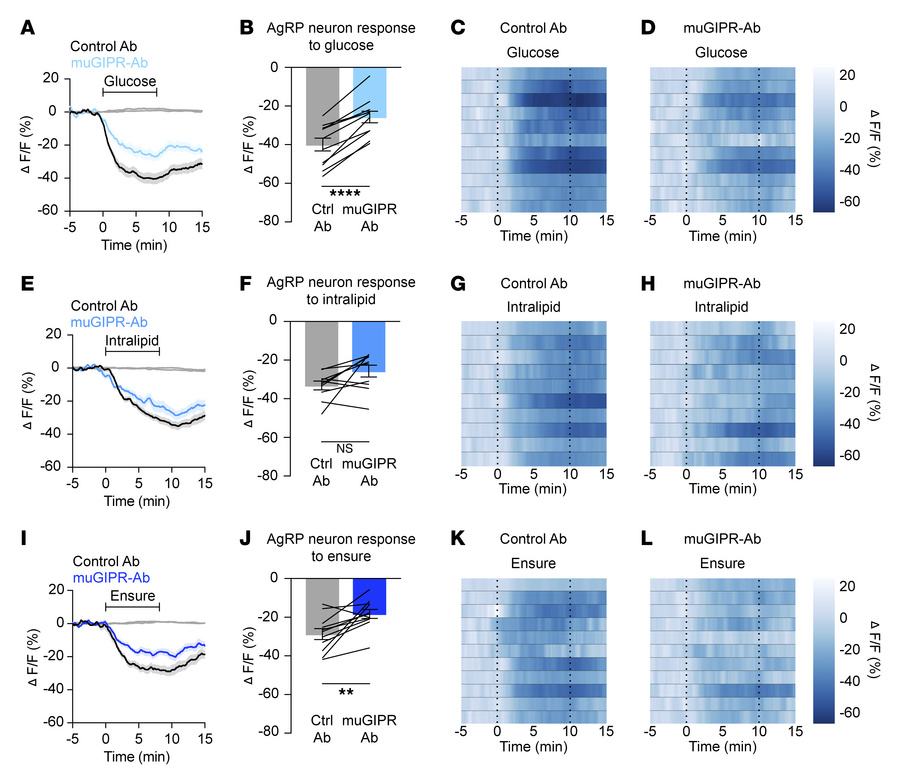 GIPR blockade partially attenuates nutrient-mediated AgRP neuron inhibit...