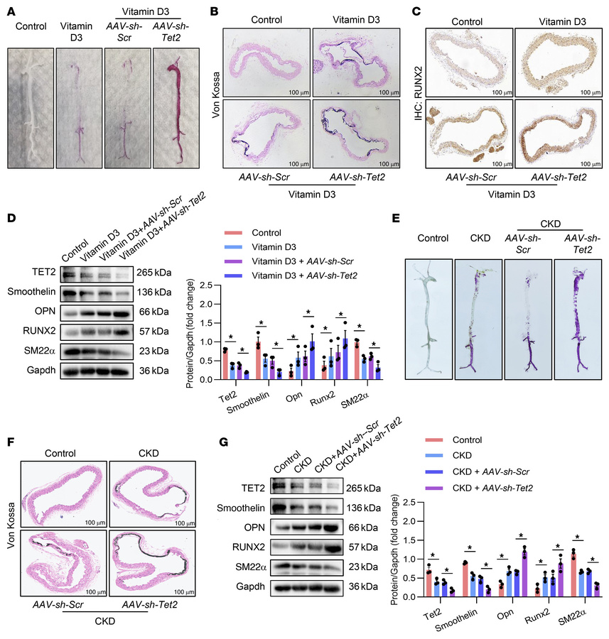 VSMC-specific loss of Tet2 in mice aggravated VC.
(A) Representative ali...