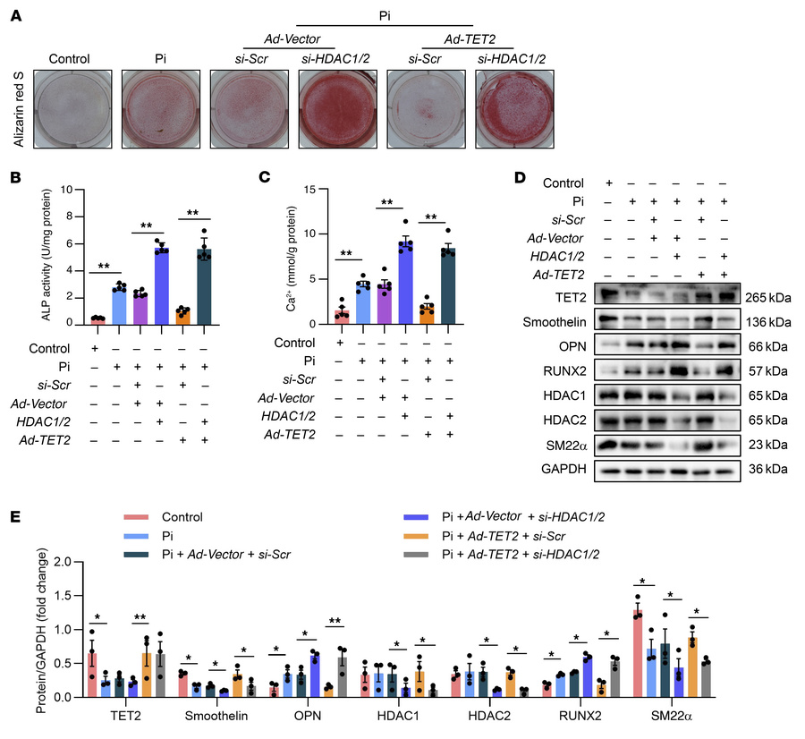 TET2 inhibits hVSMC osteogenic transdifferentiation by interacting with ...
