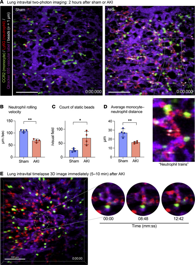 Intravascular lung capillary “neutrophil train” formation after AKI.
(A)...