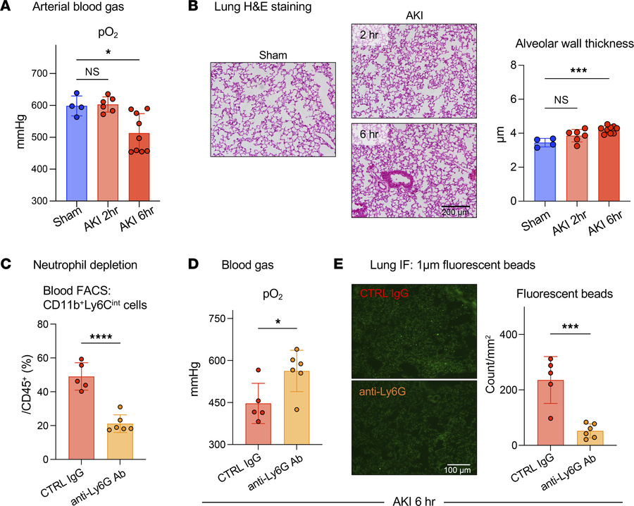 Hypoxemia is observed early after AKI in the absence of impaired ventila...