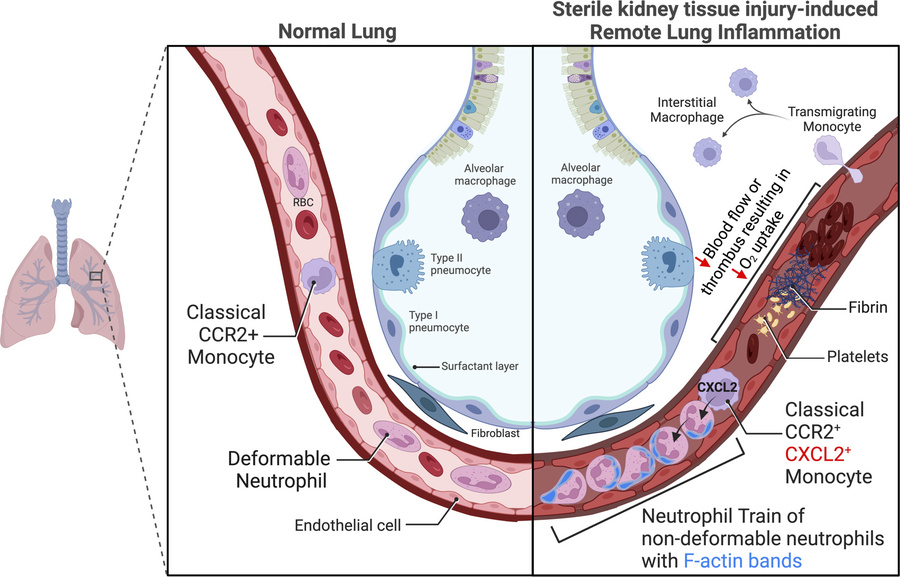 graphical abstract
