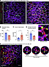 Intravascular lung capillary “neutrophil train” formation after AKI.