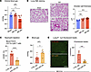 Hypoxemia is observed early after AKI in the absence of impaired ventilatio