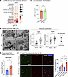 Rapid lung capillary neutrophil capture is enhanced by decreased neutrophil