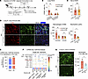 CCR2+ classical monocytes and CXCL2/CXCR2 signaling drive lung capillary ne