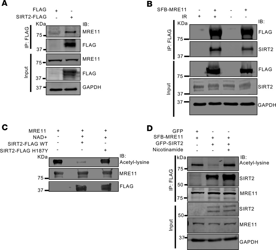 SIRT2 complexes with and deacetylates MRE11.
(A) IP of SIRT2 with anti-F...