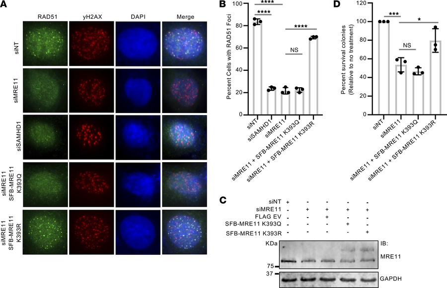 MRE11 acetylation at K393 impairs HR.
(A) U20S cells were either not sil...