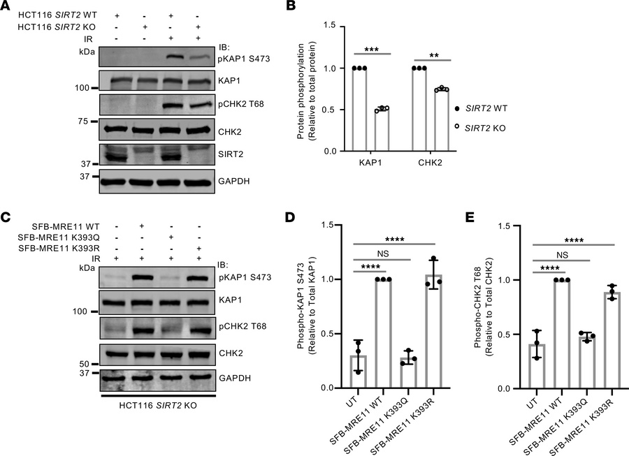 MRE11 K393 deacetylation by SIRT2 promotes ATM-dependent signaling.
(A) ...
