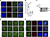 SIRT2 promotes MRE11 localization to DNA damage sites.