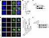SIRT2 deacetylase activity promotes DNA end resection.