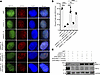 MRE11 K393 deacetylation by SIRT2 promotes DNA end resection.
