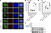 MRE11 acetylation at K393 impairs HR.