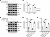 MRE11 K393 deacetylation by SIRT2 promotes ATM-dependent signaling.