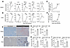 T.cruzi infection induces HIF-1α stabilization in T cells from target tissu