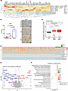 Elevated expression of ST6GalNAc-I in LUAD and its oncogenic role in LUAD.