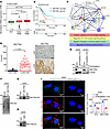 Overexpression of NECTIN2 in LUAD and tumor cell sialylation.