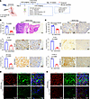 MUC5AC is associated with angiogenesis and tumor development.