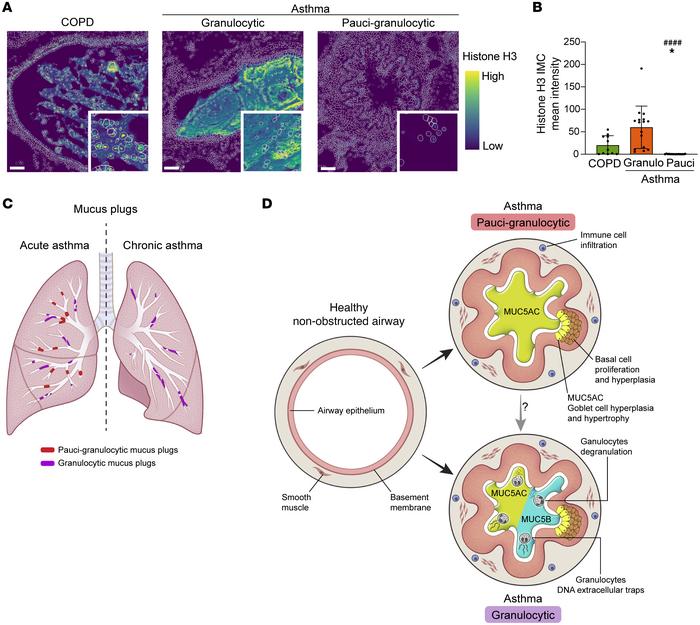 Granulocytic mucus plugs have increased numbers of extracellular DNA tra...