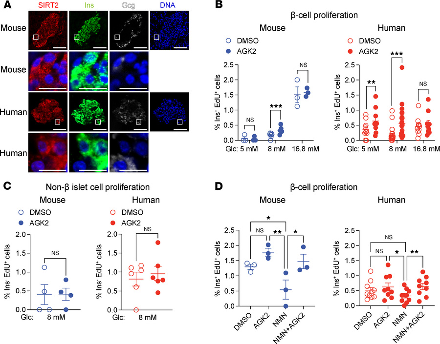 SIRT2 inhibition stimulates β cell proliferation in a glucose-dependent ...