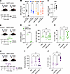 β Cell–targeted Sirt2 ASO enhances β cell proliferation under hyperglycemic