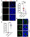 Thyroid cell death and discontinuity of the apical barrier in hypothyroid T