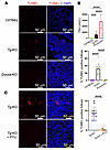 Thyroid cell death is inhibited by disruption upon impairment of the enzyma