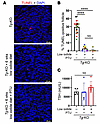 Thyroid cell death is suppressed in Tg-KO mice on a low-iodide diet.