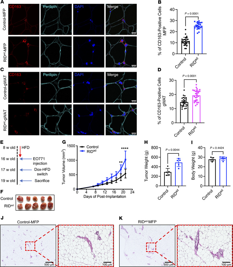 Increased TAM accumulation and accelerated tumor growth in the MFP of RI...
