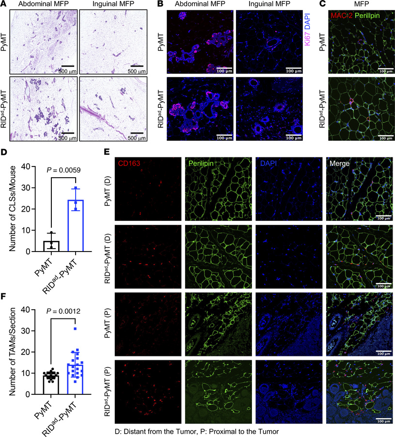 Increased CLS formation and TAM accumulation at early stages of tumor de...