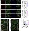 Increased adipocyte apoptosis and crown-like structure formation in RIDad m