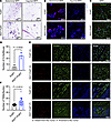 Increased CLS formation and TAM accumulation at early stages of tumor devel